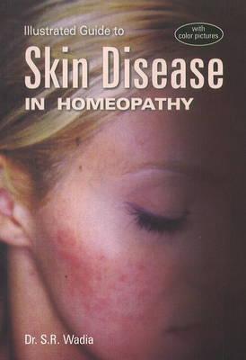 Illustrated Guide to Skin Diseases