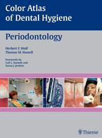 Color Atlas of Dental Hygiene: Periodontology 1st Edition