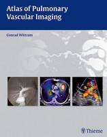 Atlas of Pulmonary Vascular Imaging 1st Edition