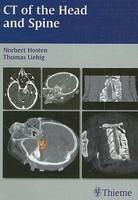 CT of the Head and Spine 1st Edition