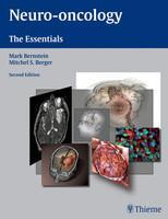 Neuro-oncology: The Essentials 2nd Edition