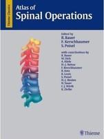 Atlas of Spinal Operations 1st Edition