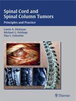 Spinal Cord and Spinal Column Tumors: Principles and Practice 1st Edition