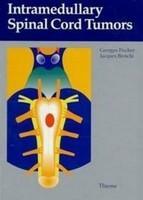 Intramedullary Spinal Cord Tumors 1st Edition