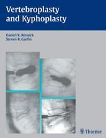 Vertebroplasty and Kyphoplasty 1st Edition