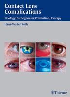 Contact Lens Complications 1st Edition