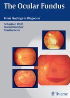 The Ocular Fundus from Findings to Diagnosis 1st Edition