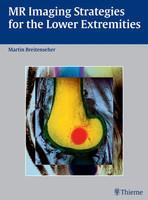 MR Imaging Strategies for the Lower Extremities 1st Edition