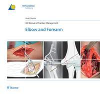 AO Manual of Fracture Management: Elbow and Forearm 1st Edition