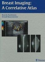 Breast Imaging: A Correlative Atlas 1st Edition