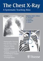 The Chest X-Ray: A Systematic Teaching Atlas 1st Edition