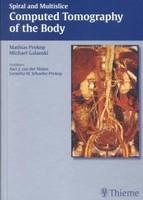 Spiral and Multislice Computed Tomography of the Body 1st Edition