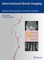 Interventional Breast Imaging: Ultrasound, Mammography and MR Guidance Techniques 1st Edition