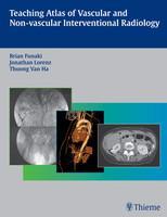 Teaching Atlas of Vascular and Non-vascular Interventional Radiology 1st Edition