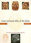 Cross-Sectional Atlas of the Brain [With DVD-ROM] annotated edition Edition