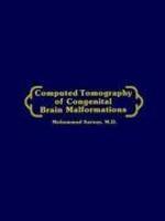 Computed Tomography of Congenital Brain Malformations
