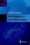 New Procedures in Open Hernia Surgery