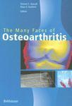 The Many Faces of Osteoarthritis illustrated edition Edition