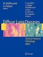 Diffuse Lung Diseases: Clinical Features, Pathology, Hrct 1st ed. 2006th Edition