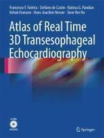 Atlas of Real Time 3D Transesophageal Echocardiography [With CDROM] 1st Edition. Edition