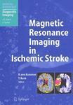 Magnetic Resonance Imaging in Ischemic Stroke 1st Edition