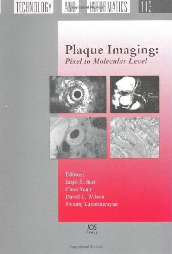 Plaque Imaging: Pixel to Molecular Level (Studies in Health Technology and Informatics, Vol. 113) 