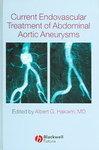 Current Endovascular Treatment of Abdominal Aortic Aneurysms