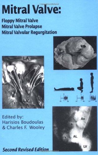 Mitral Valve: Floppy Mitral Valve, Mitral Valve Prolapse, Mitral Valvular Regurgitation 