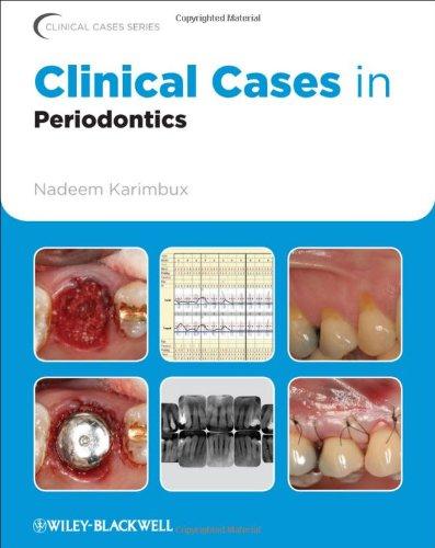 Clinical Cases in Periodontics 