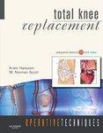 Total Knee Replacement [With DVD] Har/Onl/Dv Edition