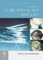 An Atlas of Hair and Scalp Diseases
