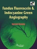 Fundus Fluorescein and Indocyanine Green Angiography