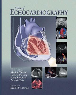 Atlas of Echocardiography