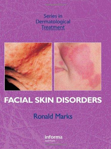 Facial Skin Disorders