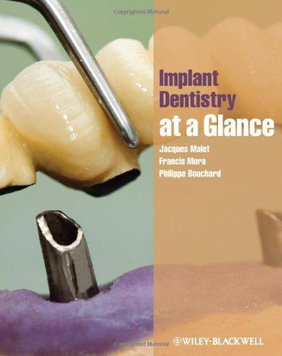 Implant Dentistry at a Glance 