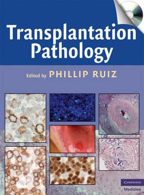 Transplantation Pathology (Cambridge Medicine)