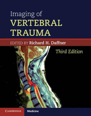 Imaging of Vertebral Trauma (Cambridge Medicine)