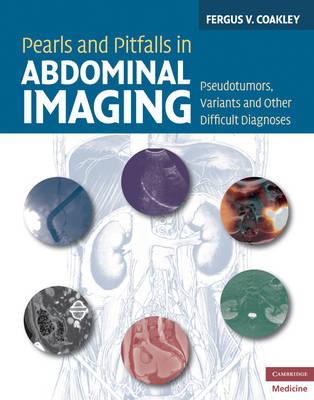 Pearls and Pitfalls in Abdominal Imaging: Pseudotumors, Variants and Other Difficult Diagnoses (Cambridge Medicine)