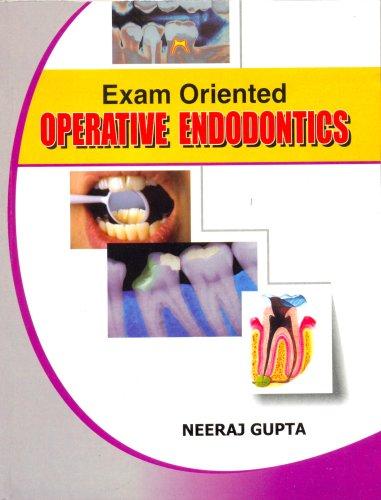 Exam Oriented Operative Endodontics